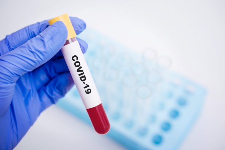 Megkezdődik az emberi kísérleti szakasza egy potenciális antitest-alapú COVID-19 gyógymódnak
