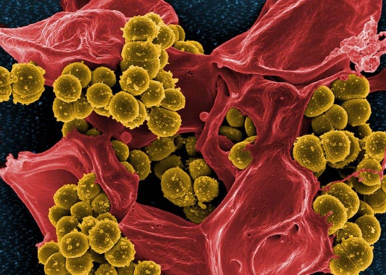 Újabb országban jelent meg a legveszélyesebb koronavírus-mutáció