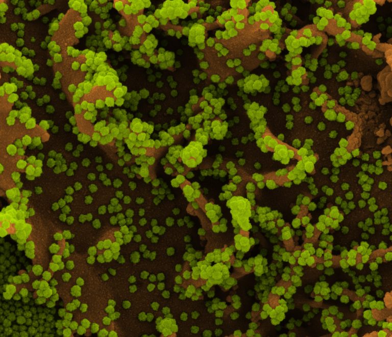 Kutatók rájöttek, mi okozhatja az új koronavírustörzs rohamos terjedését