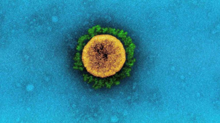Kiderült az indiai koronavírus-mutációról, hogy képes újrafertőzni