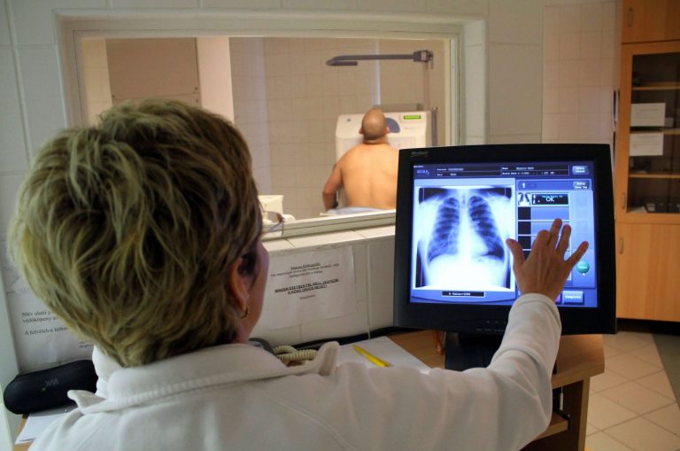 Már nem a tüdőrák a leggyakoribb rákos megbetegedés a világon