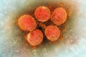 Jakab Ferenc: Magyarországnak is fel kell készülnie az indiai koronavírus-mutációra