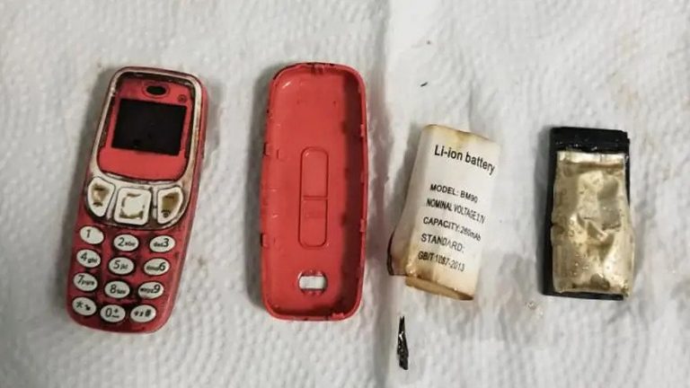 Nokia 3310-est vacsorázott egy férfi, életmentő műtétet kellett végrehajtani rajta