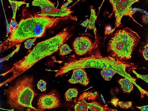 Nanorészecskékkel semlegesíthetőek a sejtek mélyén rejtőző szuperbaktériumok