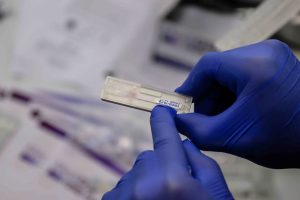 Íme a forradalmi magyar koronavírusteszt, ami kimutatja az összes mutációt