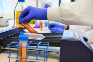 Úttörő melanomateszttel előrejelezhető a bőrrák kialakulása