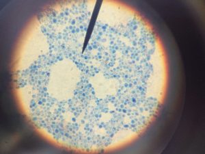 A vírusszezon után beköszönthet a gyógyszerrezisztens szuperbaktériumok kora