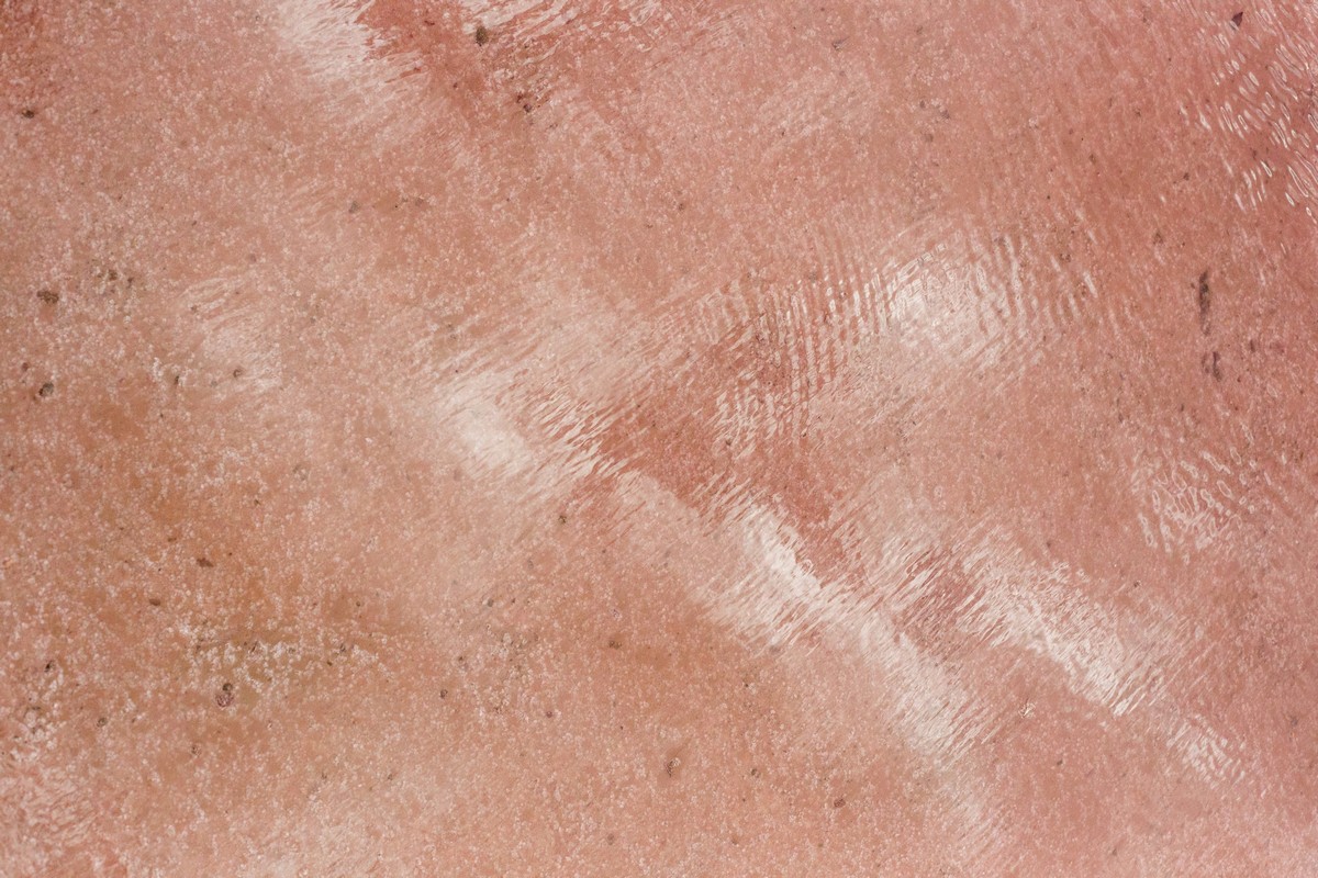 Riasztó adat érkezett a rohamosan terjedő rákfajtáról, ezt a korosztályt érinti leginkább