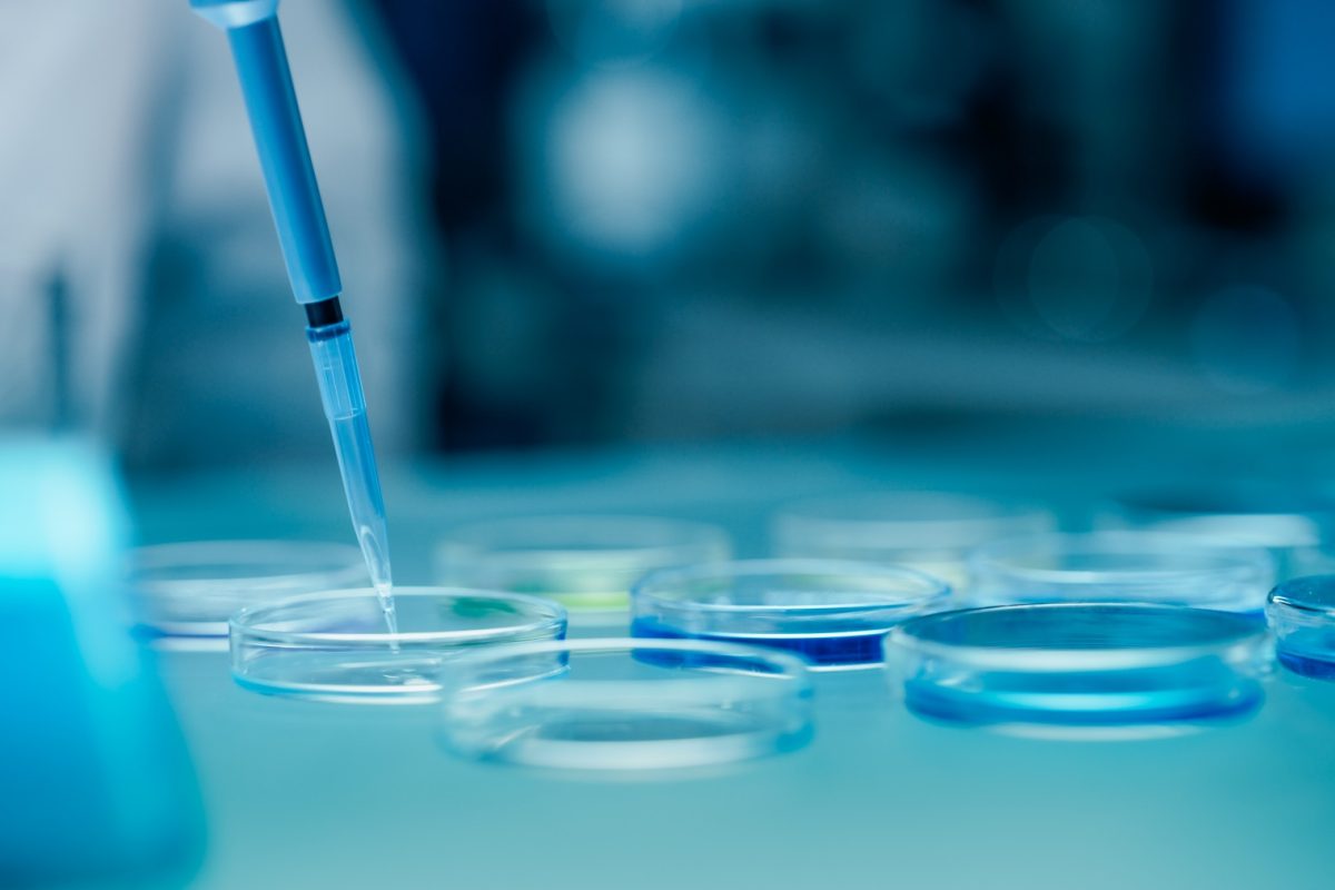 Barátját küldte el DNS-tesztre, hogy kibújjon a gyerektartás alól