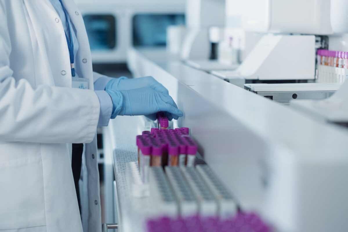 Öregedésgátló hatással bíró molekulákat találtak a vérben