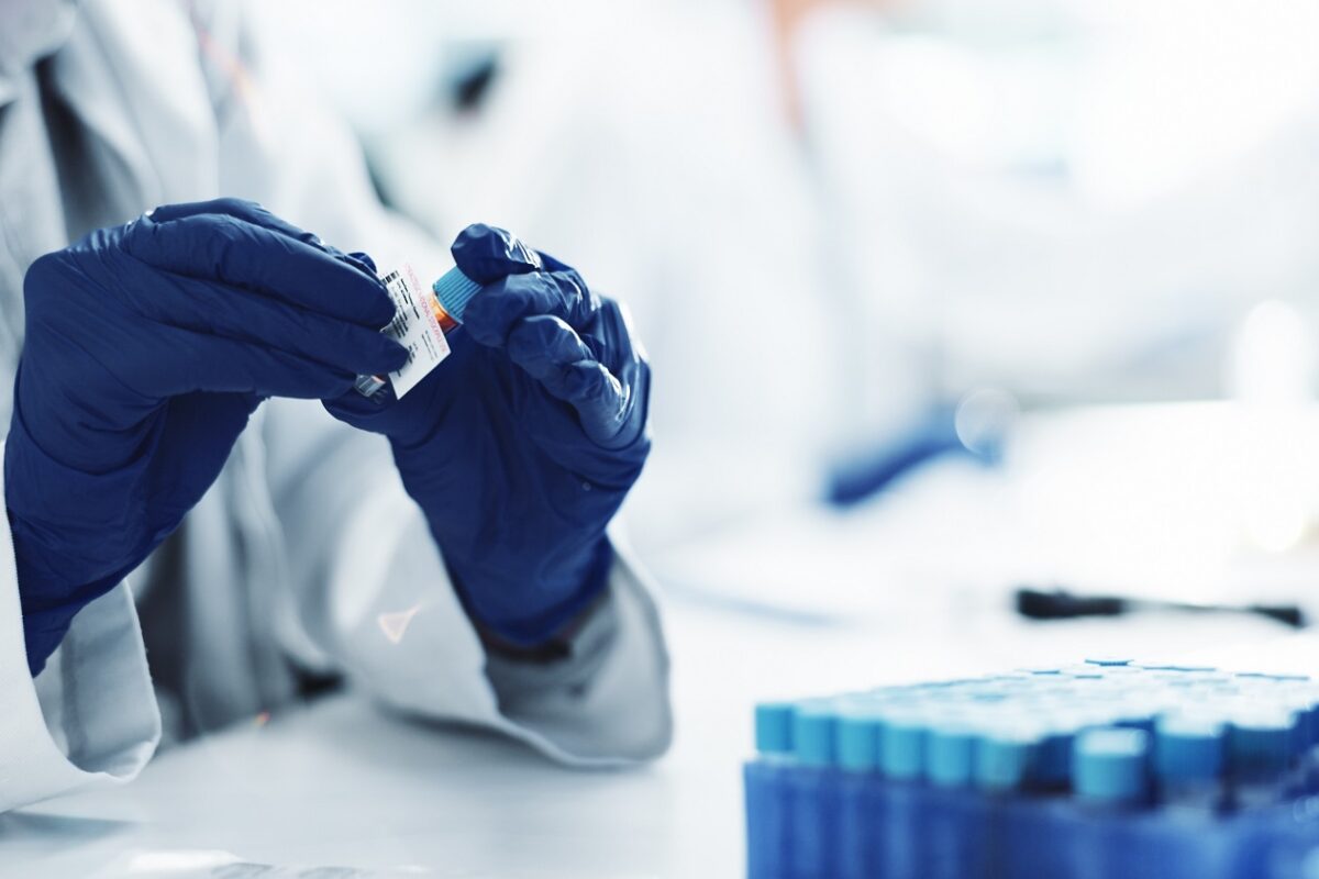 Egy bizonyos teszt, ami segíthet a megfelelő antidepresszáns kiválasztásában