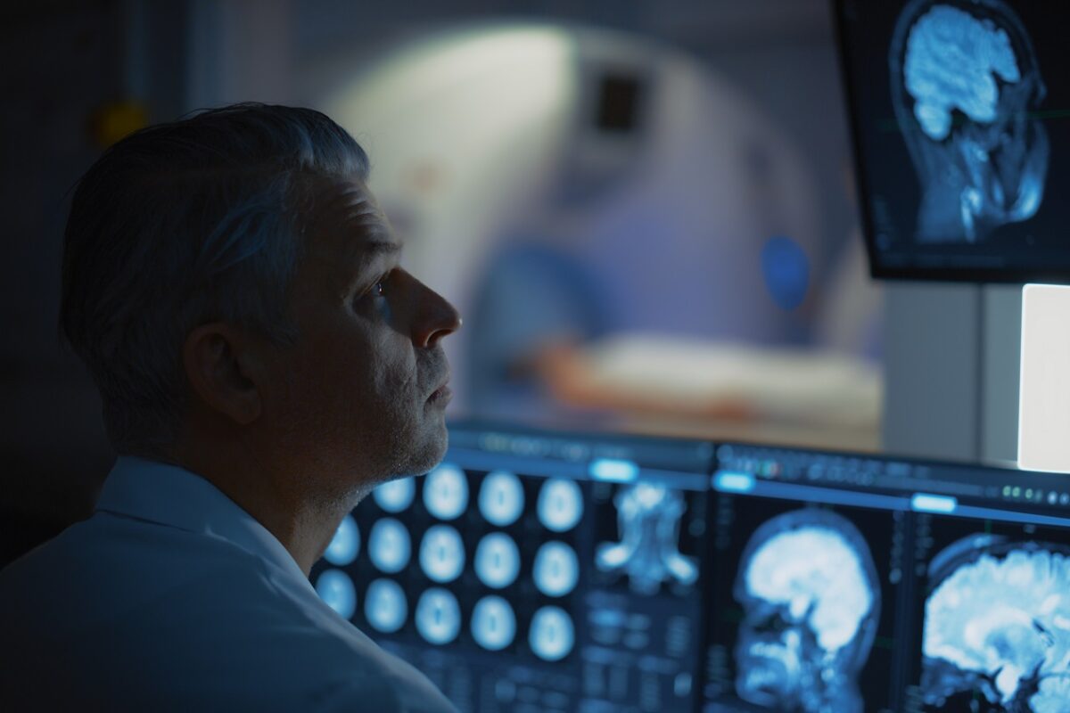 Az agydaganat évekkel korábban kialakulhat, mint hogy az orvosok észrevennék