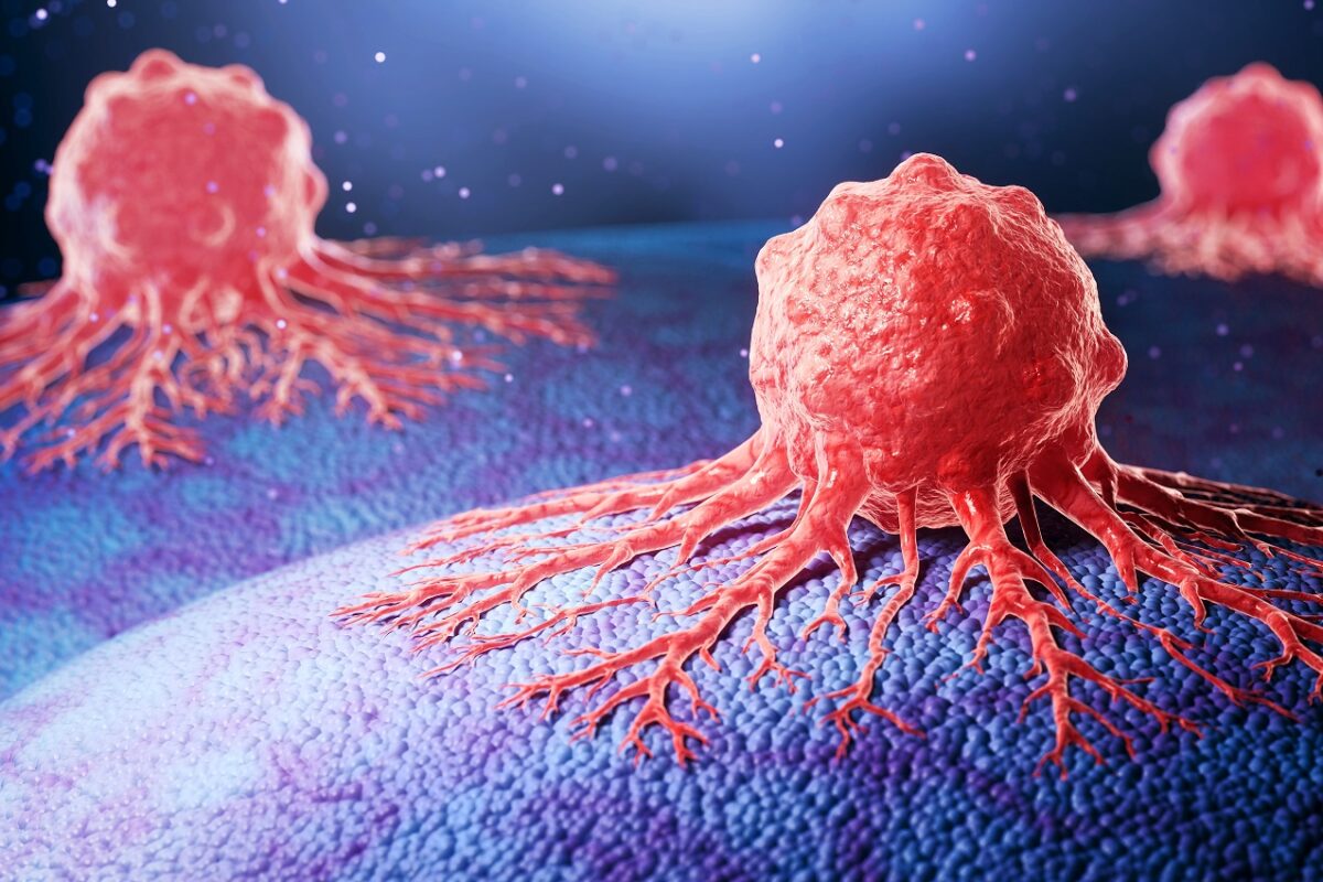 Forradalmi áttörés a rákgyógyászatban – baktériumokkal falnák fel a daganatokat belülről