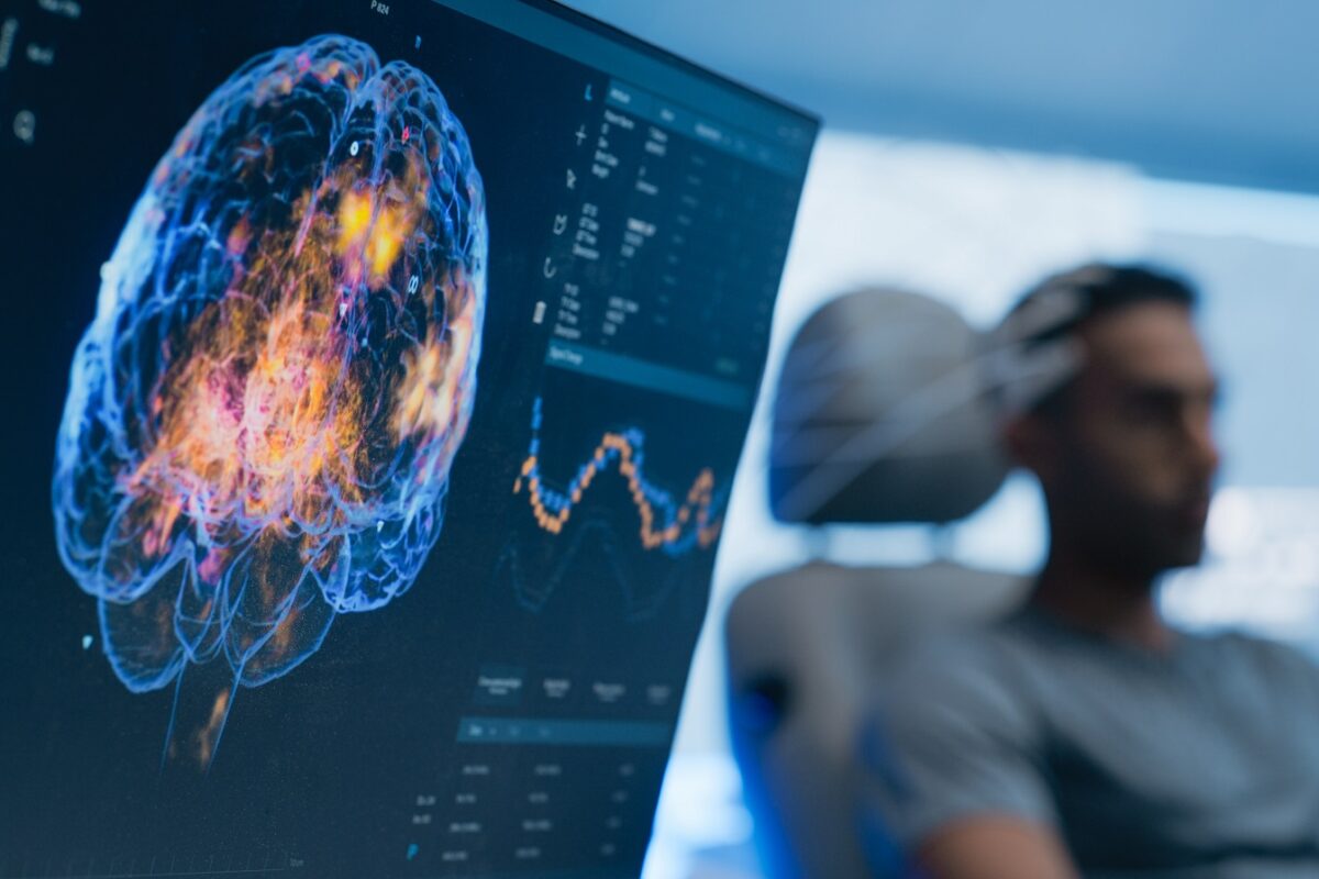 Végre kiderült, mi állhat az agyunk hanyatlásának hátterében – félelmetes és érdekes