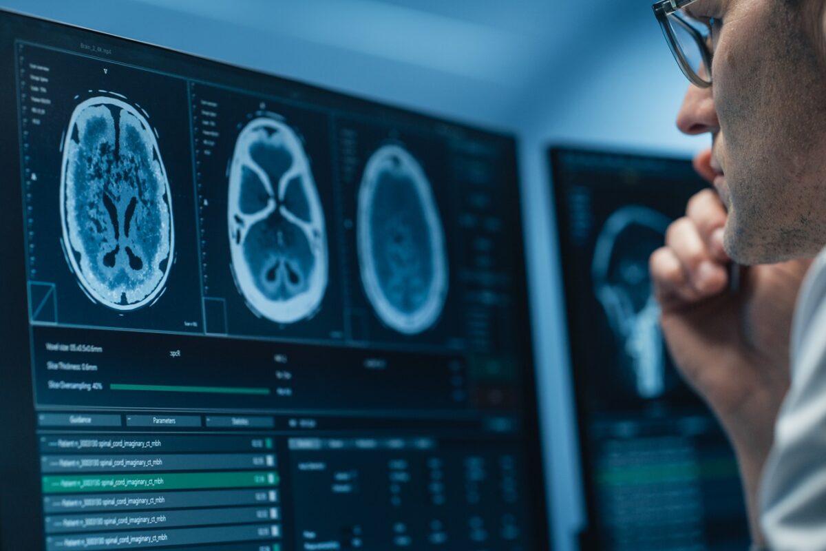 Meglepő, mennyien nem tudják, mi történik az aggyal halál után